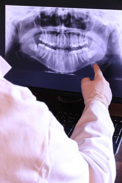 Best Broken Tooth Emergency  in Timberlane, IL