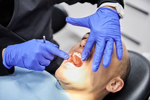 Best Emergency Gum Pain Relief  in Timberlane, IL